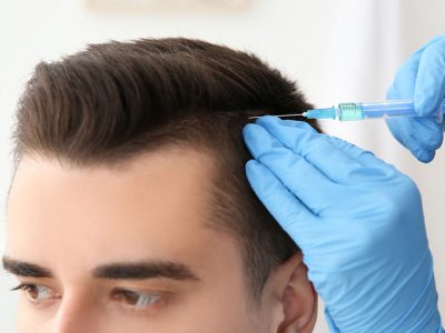 Saç Mezoterapisi Nedir?